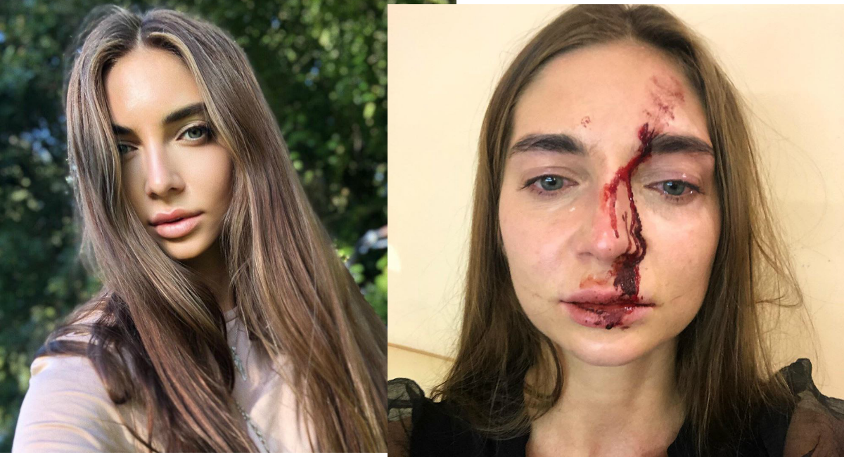 Salt: главное здесь, остальное по вкусу - Врач-косметолог избила девушку в московском салоне красоты