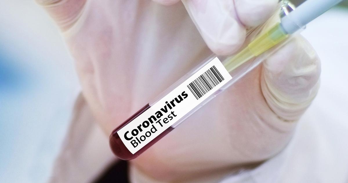 Salt: главное здесь, остальное по вкусу - Москвич рассказал, как стал добровольцем для тестирования вакцины от коронавируса